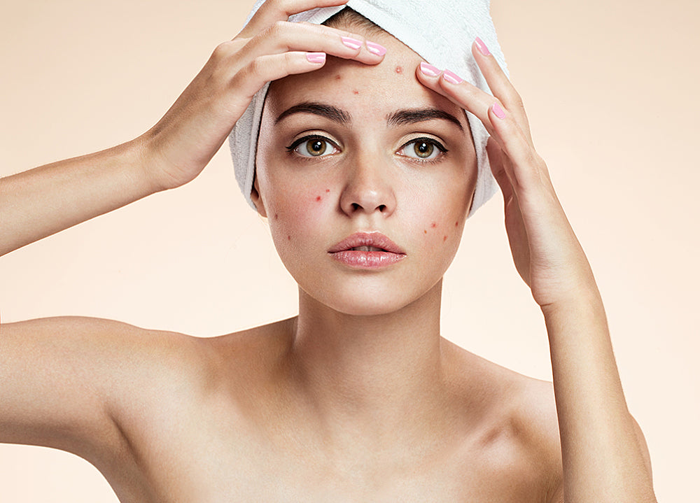 Understanding the types of breakouts - then what to do !